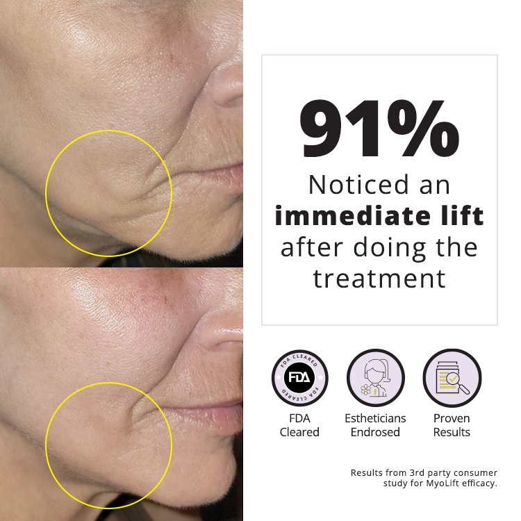 facial skin tightener